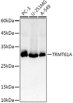 TRMT61A Antibody in Western Blot (WB)