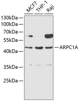 ARPC1A Antibody in Western Blot (WB)