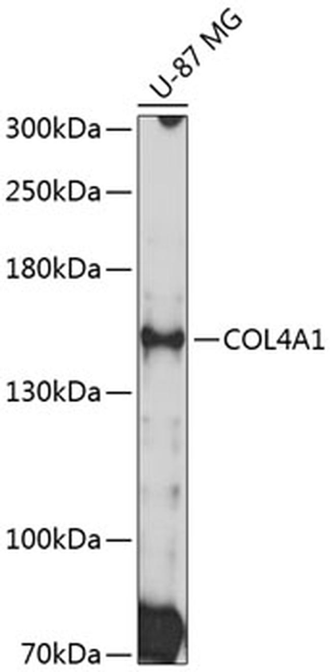 COL4A1 Antibody in Western Blot (WB)
