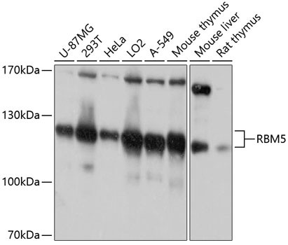 RBM5 Antibody in Western Blot (WB)