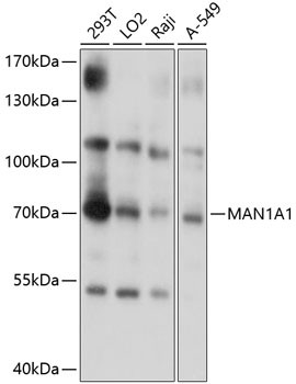 MAN1A1 Antibody in Western Blot (WB)