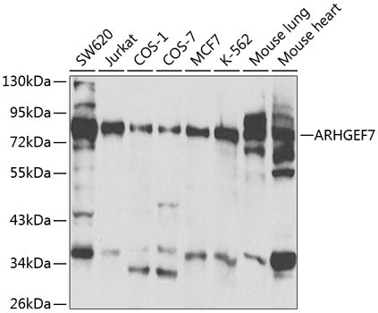 ARHGEF7 Antibody in Western Blot (WB)