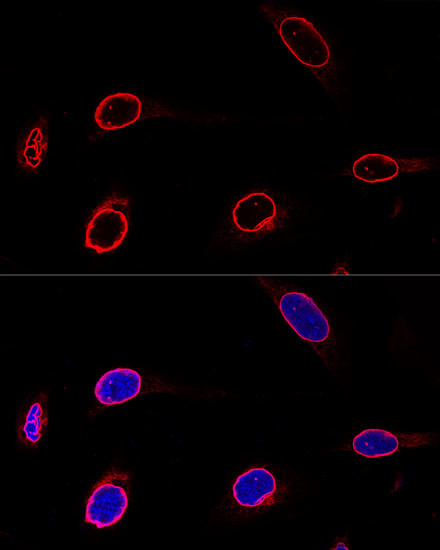 Emerin Antibody in Immunocytochemistry (ICC/IF)
