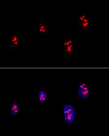 Fibrillarin Antibody in Immunocytochemistry (ICC/IF)