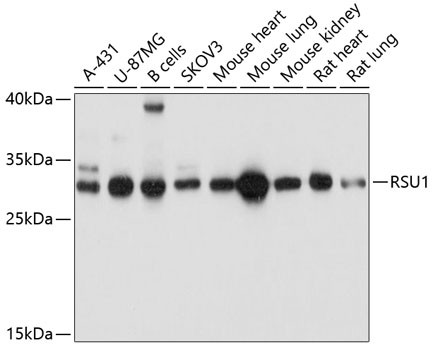RSU1 Antibody in Western Blot (WB)