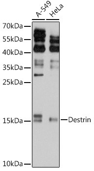 Destrin Antibody in Western Blot (WB)