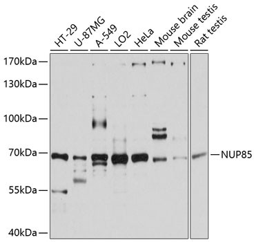 NUP85 Antibody in Western Blot (WB)