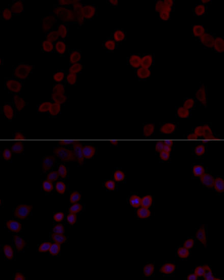 PP5 Antibody in Immunocytochemistry (ICC/IF)