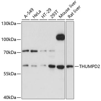 THUMPD2 Antibody in Western Blot (WB)