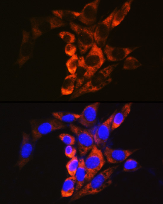 Calpain 1 Antibody in Immunocytochemistry (ICC/IF)