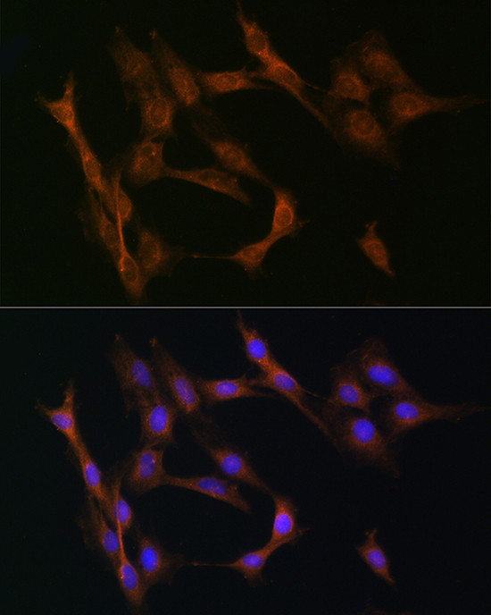 TGFBR2 Antibody in Immunocytochemistry (ICC/IF)
