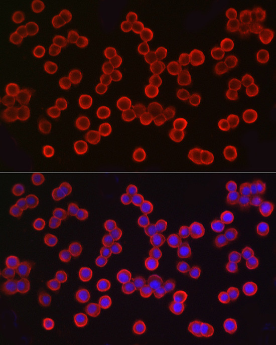 EpCAM Antibody in Immunocytochemistry (ICC/IF)