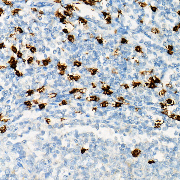 CD8 Antibody in Immunohistochemistry (Paraffin) (IHC (P))