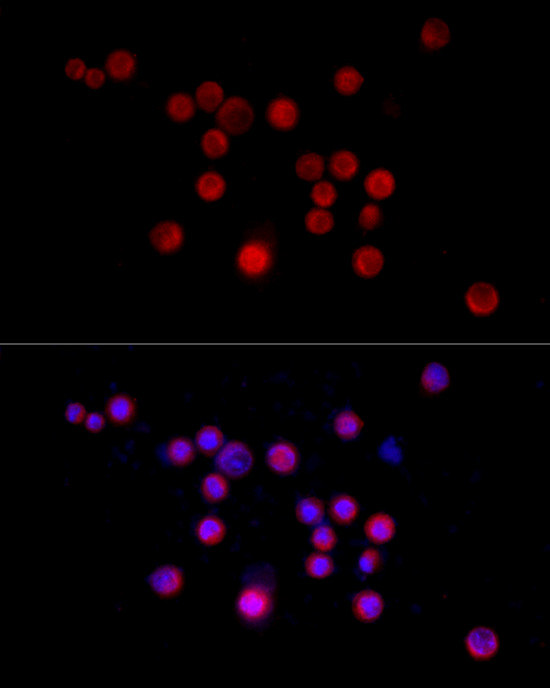 Nestin Antibody in Immunocytochemistry (ICC/IF)