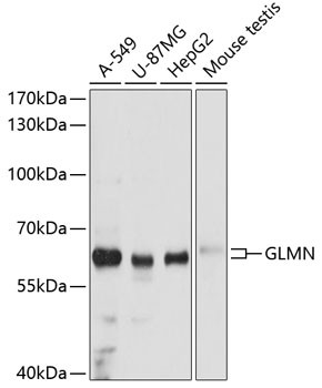 GLMN Antibody in Western Blot (WB)