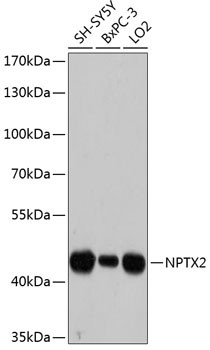 NPTX2 Antibody in Western Blot (WB)