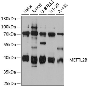 METTL2B Antibody in Western Blot (WB)