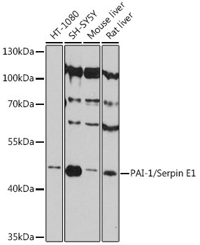 PAI1 Antibody in Western Blot (WB)
