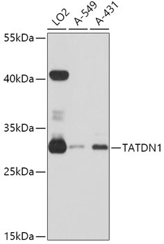 TATDN1 Antibody in Western Blot (WB)