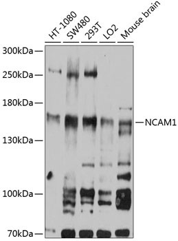 CD56 Antibody in Western Blot (WB)