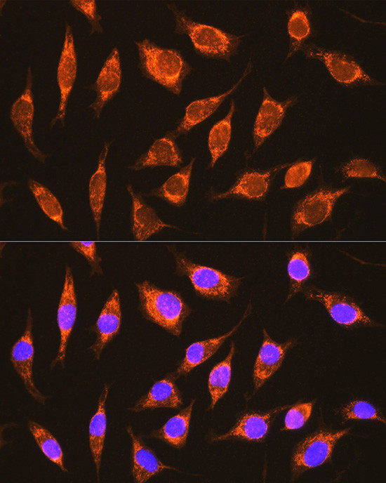 NDUFA8 Antibody in Immunocytochemistry (ICC/IF)