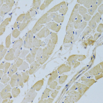 Carbonic Anhydrase III Antibody in Immunohistochemistry (Paraffin) (IHC (P))