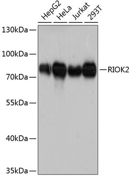 RIOK2 Antibody in Western Blot (WB)