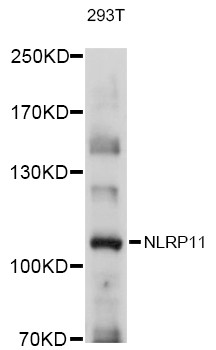NALP11 Antibody in Western Blot (WB)