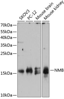 NMB Antibody in Western Blot (WB)