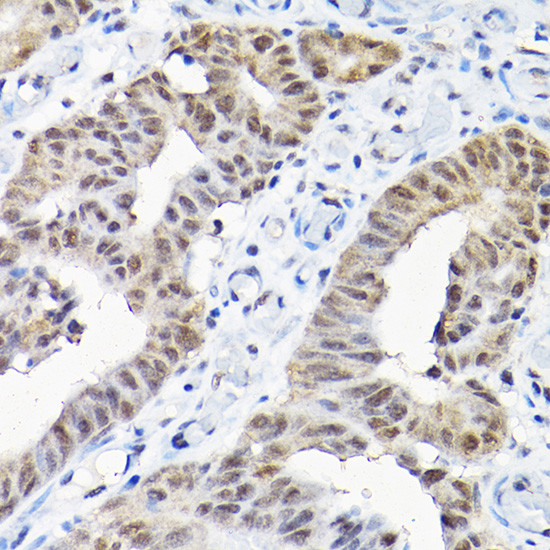 SNRPF Antibody in Immunohistochemistry (Paraffin) (IHC (P))