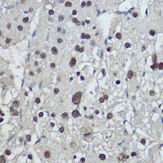 TSPYL1 Antibody in Immunohistochemistry (Paraffin) (IHC (P))