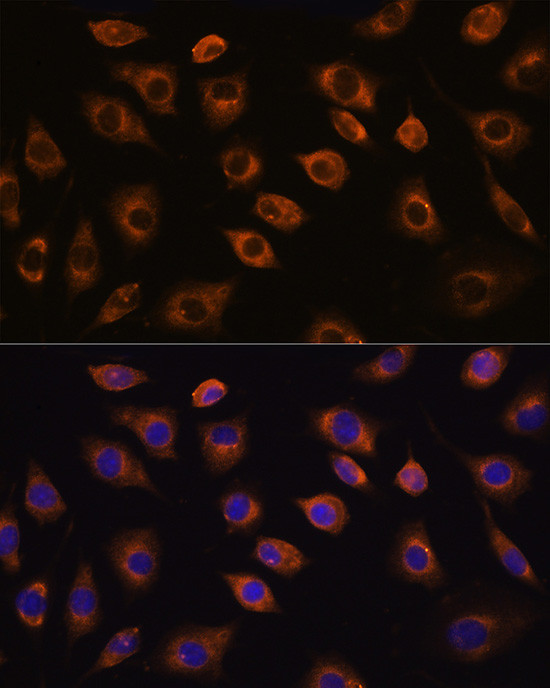 CDH11 Antibody in Immunocytochemistry (ICC/IF)