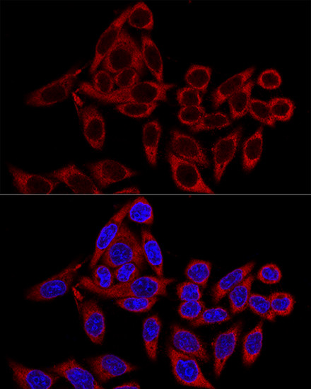 RRBP1 Antibody in Immunocytochemistry (ICC/IF)