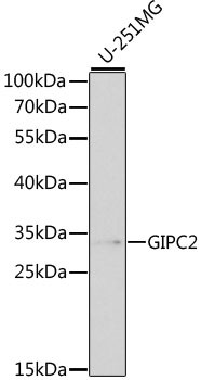 GIPC2 Antibody in Western Blot (WB)