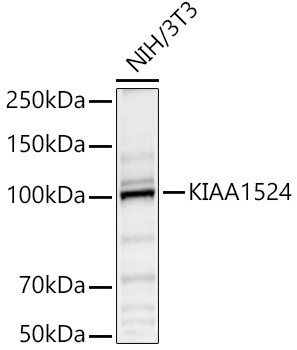 CIP2A Antibody in Western Blot (WB)