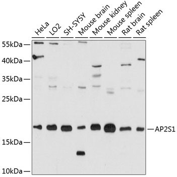 AP2S1 Antibody in Western Blot (WB)