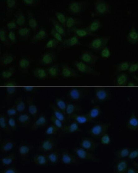 CREB Antibody in Immunocytochemistry (ICC/IF)