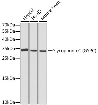 GYPC Antibody in Western Blot (WB)