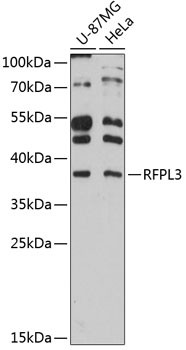 RFPL3 Antibody in Western Blot (WB)