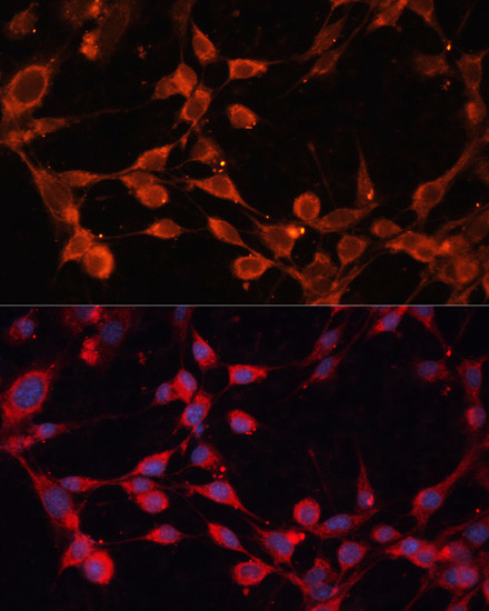 SLC25A19 Antibody in Immunocytochemistry (ICC/IF)