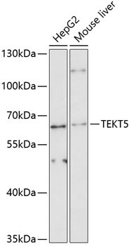 TEKT5 Antibody in Western Blot (WB)