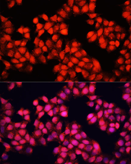 ALAD Antibody in Immunocytochemistry (ICC/IF)