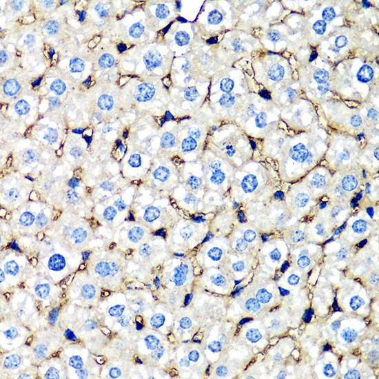 beta-2 Microglobulin Antibody in Immunohistochemistry (Paraffin) (IHC (P))