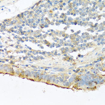 Trypsin Antibody in Immunohistochemistry (Paraffin) (IHC (P))