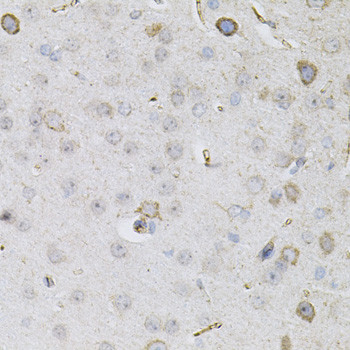 CEACAM5 Antibody in Immunohistochemistry (Paraffin) (IHC (P))