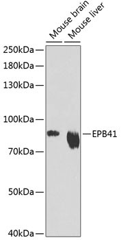 EPB41 Antibody in Western Blot (WB)