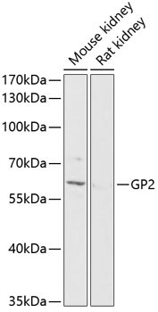 GP2 Antibody in Western Blot (WB)