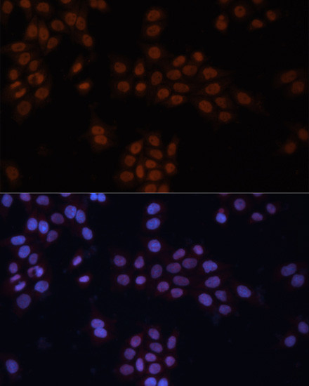GTF2I Antibody in Immunocytochemistry (ICC/IF)