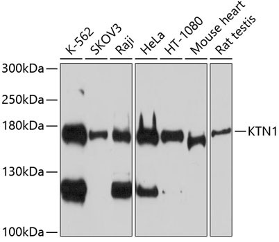 KTN1 Antibody in Western Blot (WB)