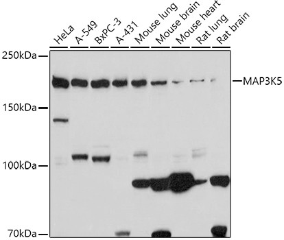 ASK1 Antibody in Western Blot (WB)